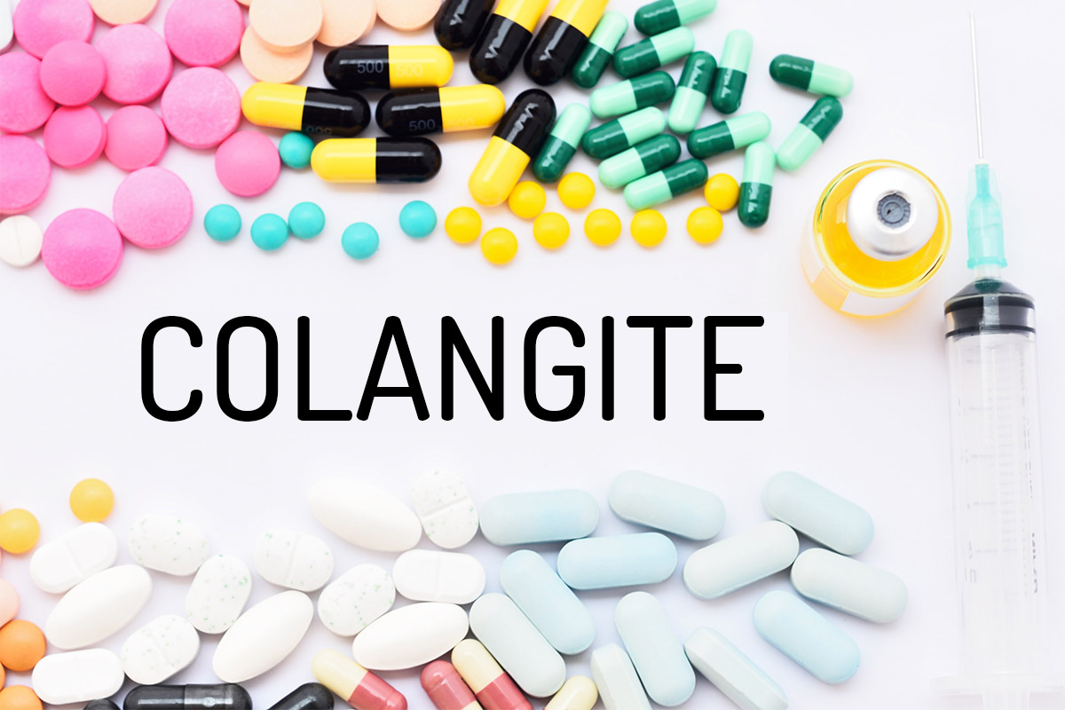 colangite: cos'è, cause, sintomi, diagnosi e cure