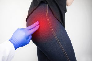 Coxartrosi: cos’è, cause, sintomi, diagnosi  e cure dell’artrosi dell’anca