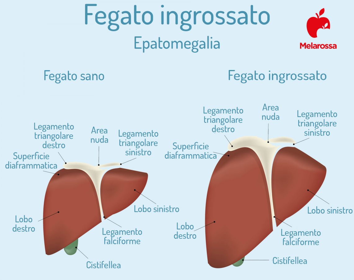 Da Che Parte Sta Il Fegato Fegato: cos’è, quali sono le sue funzioni e le principali malattie epatiche