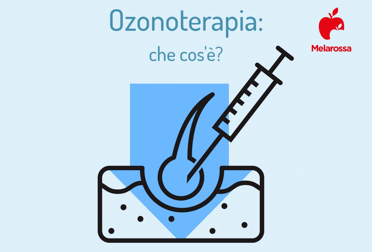 Ozonoterapia cos'è, a cosa serve, benefici e controindicazioni