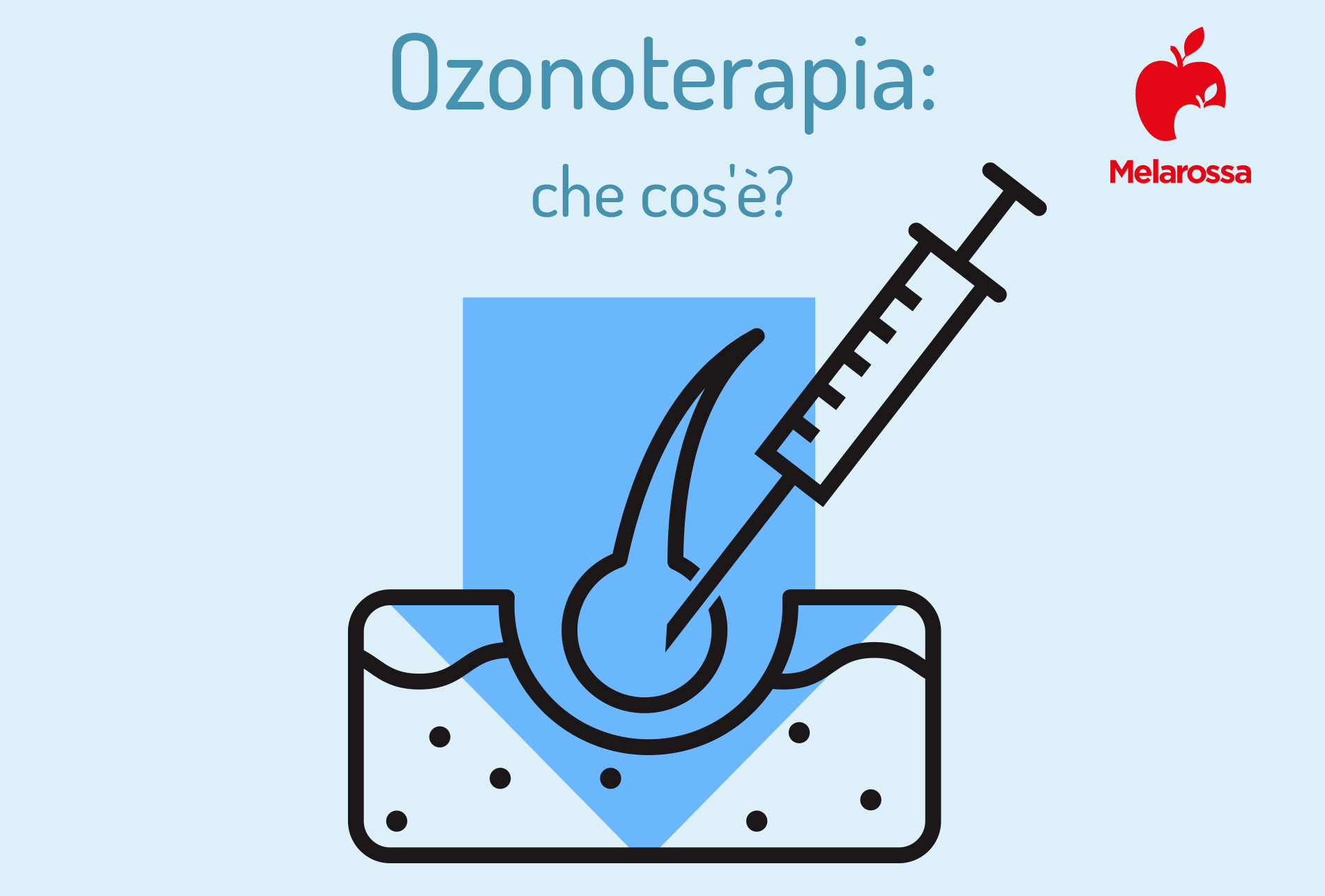 ozonoterapia: che cos'è