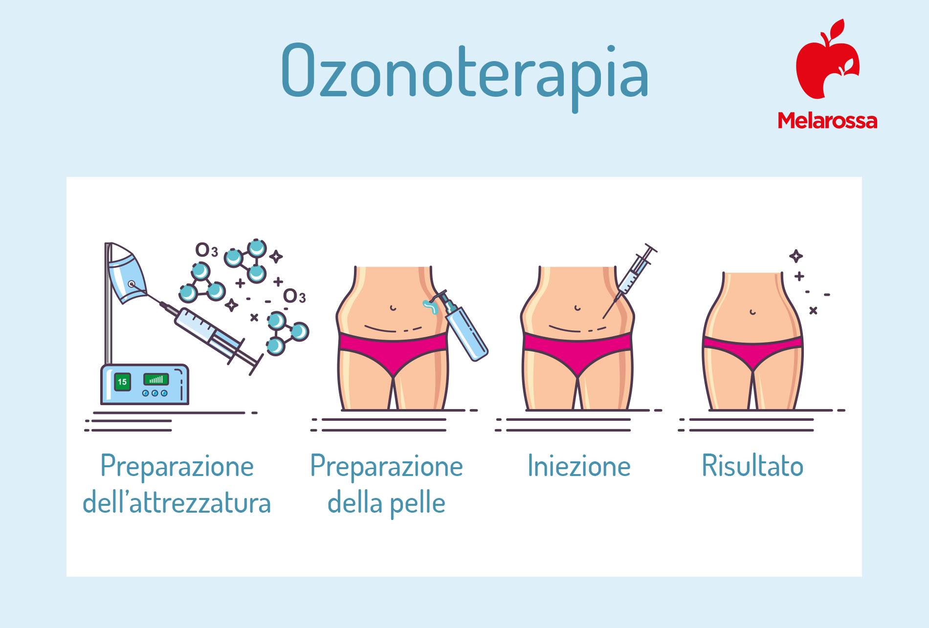 ozonoterapia: come funziona 