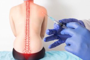 Ozonoterapia: cos’è, a cosa serve, come funziona, per quali patologie è indicata, quanto costa, benefici e controindicazioni