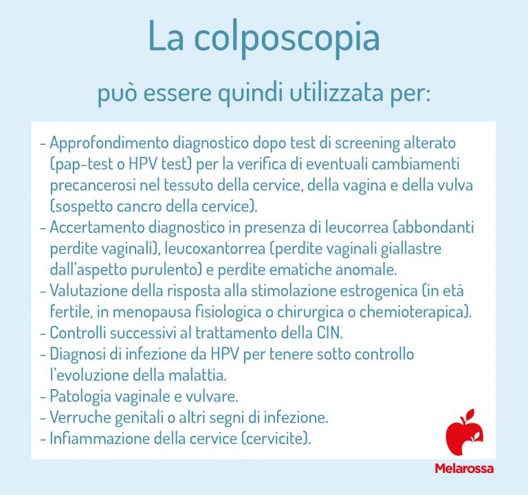 Colposcopia cos’è, a cosa serve, quando è consigliata, quanto è dolorosa Colposcopia cos’è, a cosa serve, quando è consigliata, quanto è dolorosa