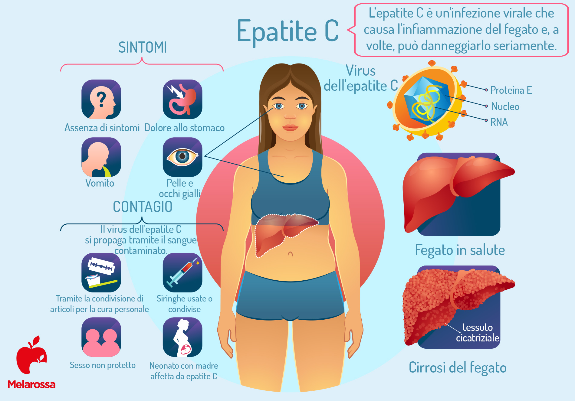 epatite C: sintomi