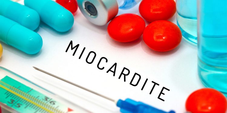 miocardite: che cos'è, cause, sintomi, diagnosi e cure