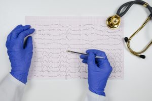 Extrasistole: cos’è, tipi, cause, sintomi, diagnosi e cure