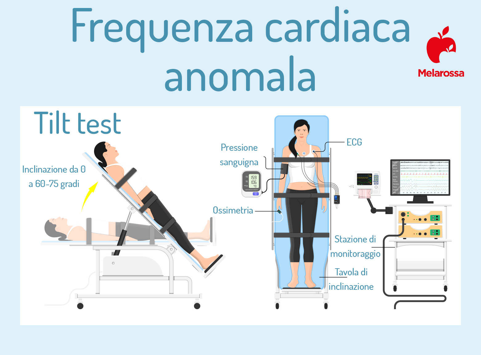 frequenza cardia anomala: Tilt test 