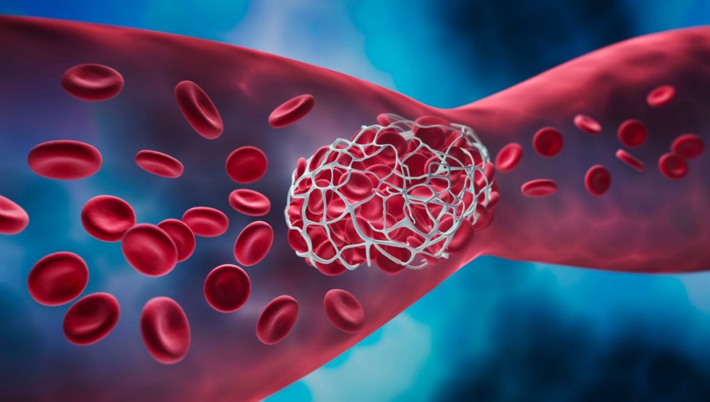 Insufficienza renale che cos'è, sintomi, cause, diagnosi, cura
