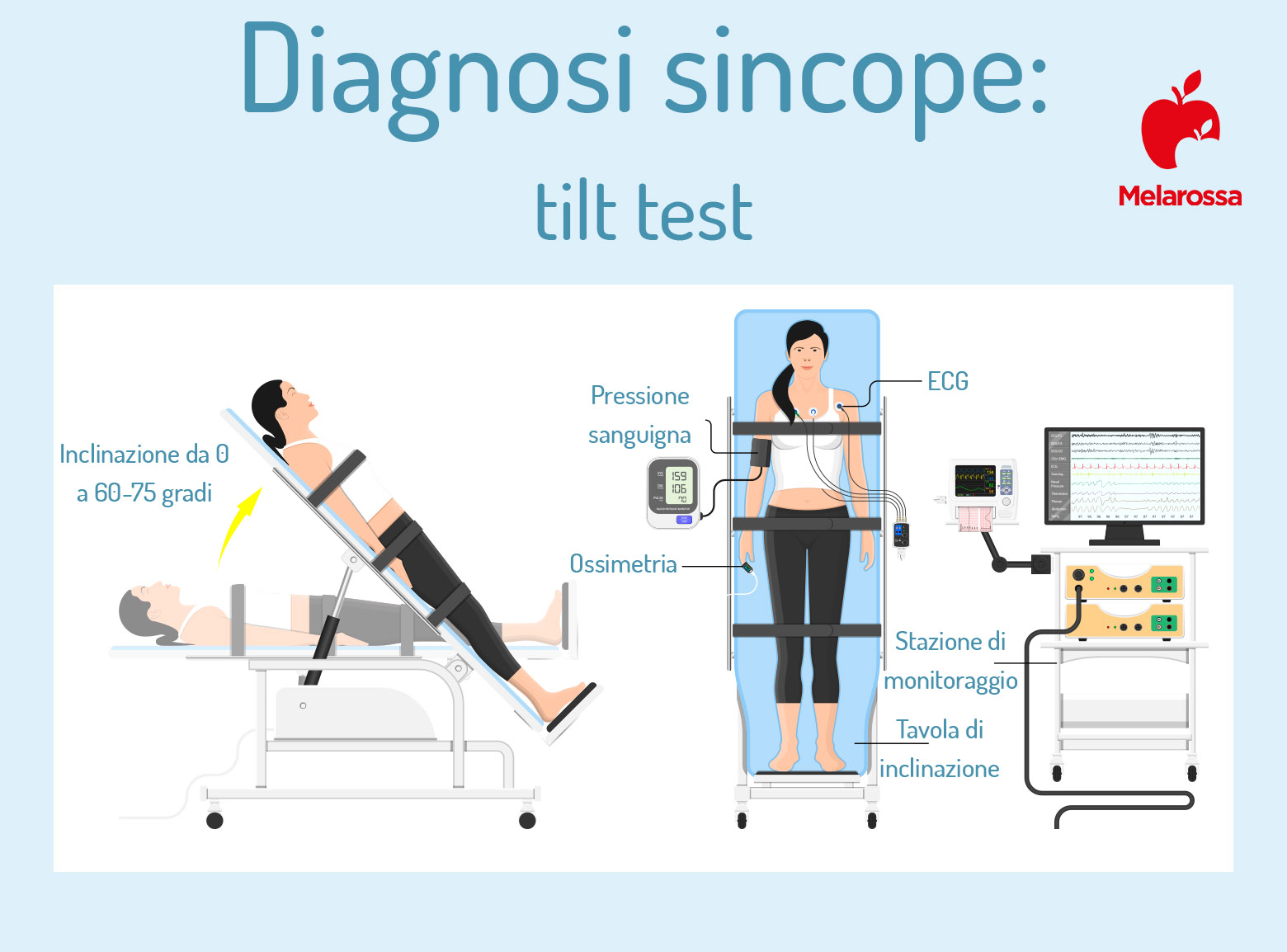 diagnosi per sincope: tilt test