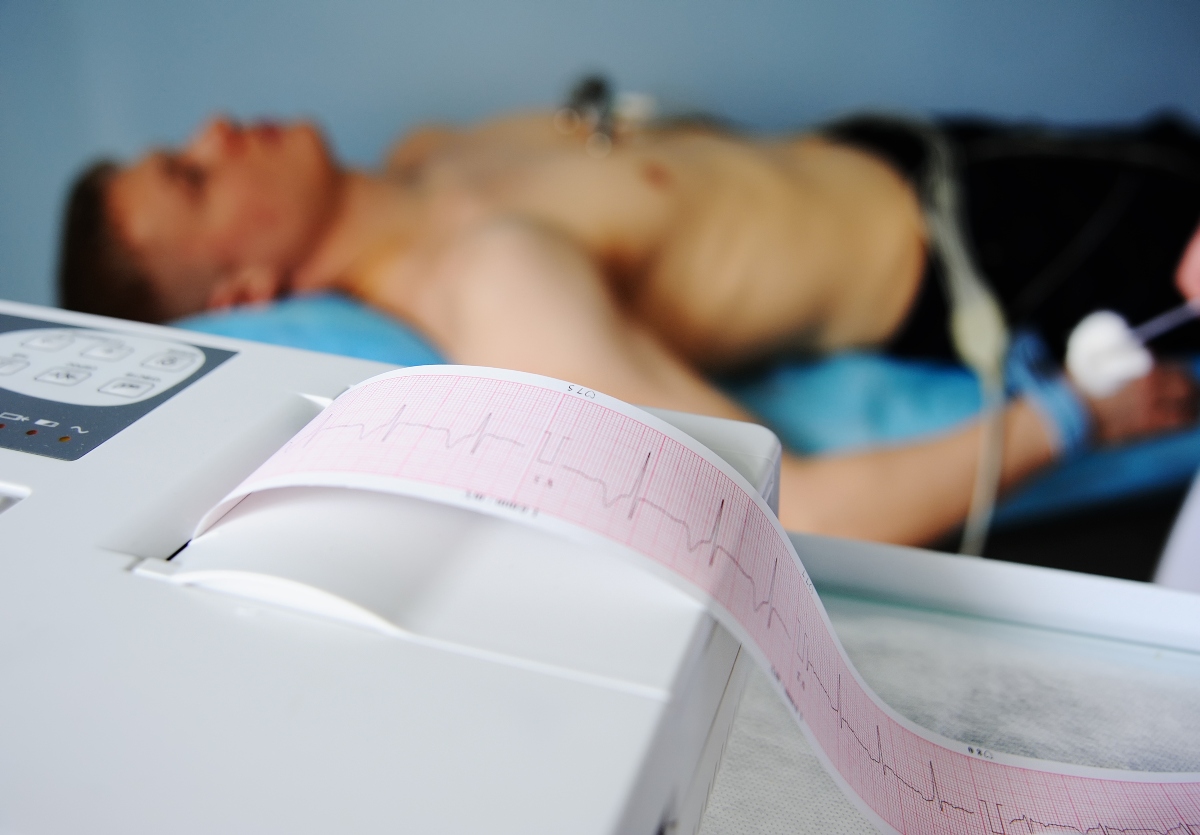 elettrocardiogramma: come si svolge l'esame