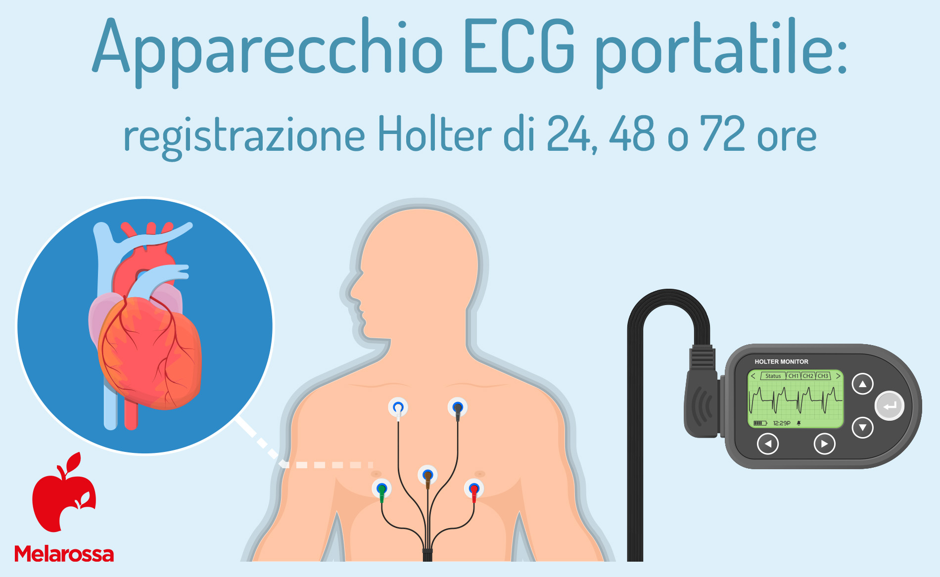 elettrocardiogramma ECG: monitoraggio Holtler
