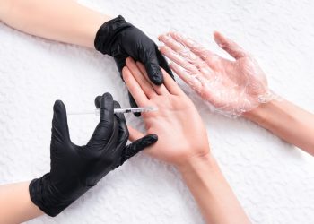 Un medico che sta eseguendo un'iniezione nelle mani di una donna che soffre di iperidrosi