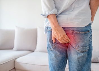 emorroidi esterne: cosa sono, sintomi, cause, diagnosi, cura e prevenzione