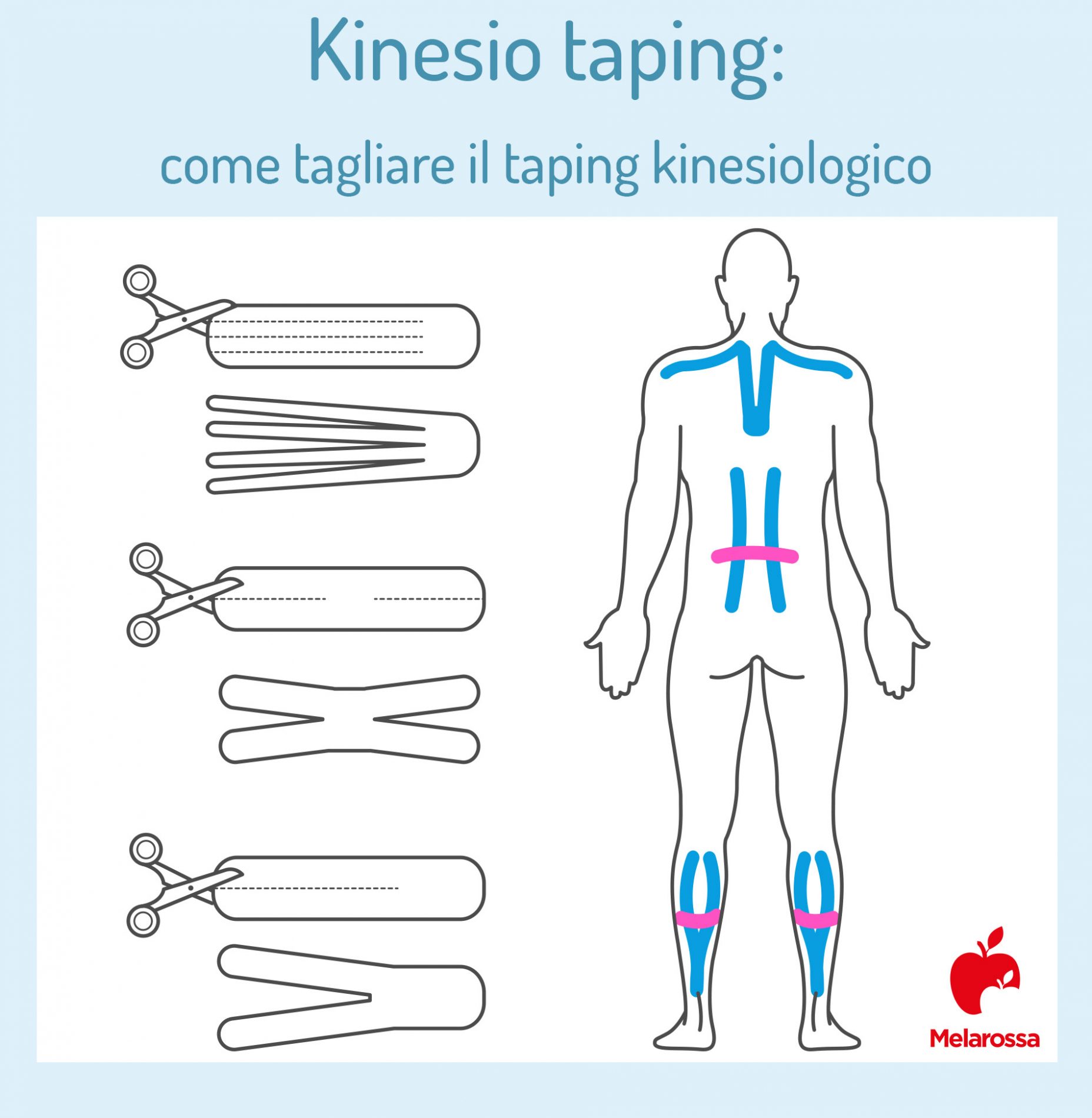 kinesio taping: come tagliare il taping kinesiologico
