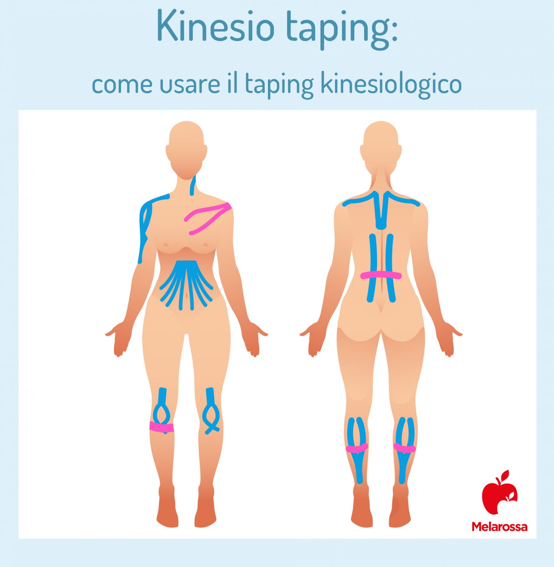 kinesio taping: come usare il tape kinesiologico
