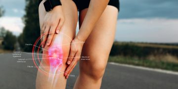 menisco: che cos'è, anatomia, sintomi e cause del menisco rotto o lesionato, diagnosi e cure