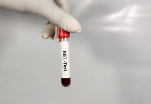 Gamma GT: che cos’è, come si misura, valori normali, cosa fare quando è alta o bassa