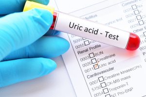 Acido urico: cos’è, come si misura e cosa fare quando l’uricemia è alta o bassa