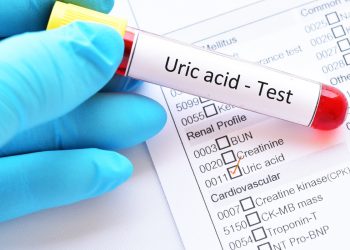 acido urico: che cos'è, analisi, valori normali, alti e bassi. Cosa fare in caso di valori anomali