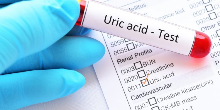 acido urico: che cos'è, analisi, valori normali, alti e bassi. Cosa fare in caso di valori anomali