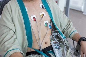Bradicardia: che cos’è, cause, sintomi, diagnosi, cure, quando preoccuparsi
