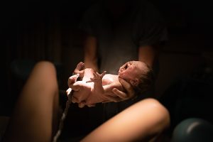 Episiotomia: che cos’è, quando è necessario il taglio vaginale, come si esegue e a cosa serve, cicatrice, guarigione e conseguenze