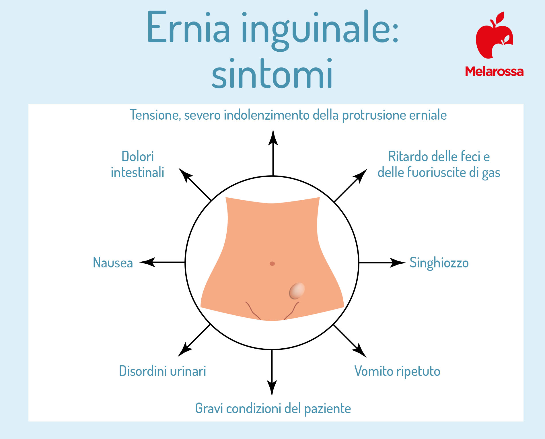 ernia inguinale: sintomi 