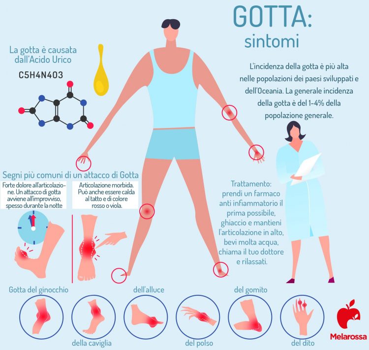 Gotta cos'è, cause, sintomi, cure e prevenzione Melarossa