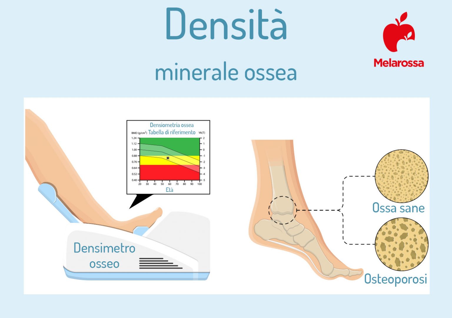 Moc: che cos'è, perché farla, come leggere i valori
