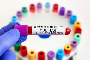 Colesterolo HDL (buono): che cos’è, valori normali e cosa fare quando è alto o basso
