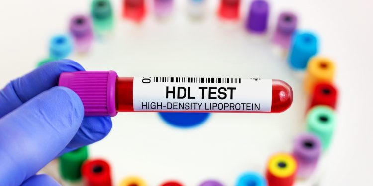colesterolo HDL: che cos'è, valori normali, cause, sintomi e cure