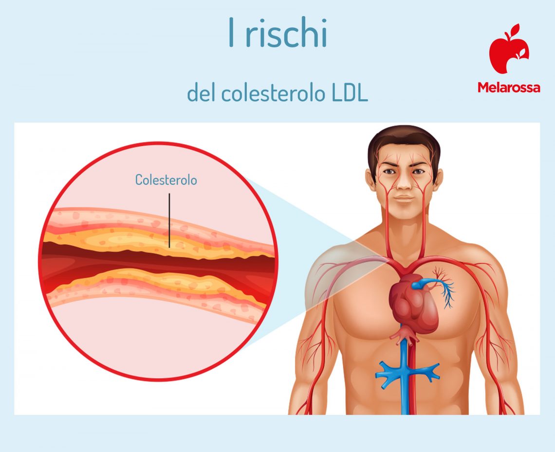 Colesterolo Ldl Alto E Trigliceridi Bassi Colesterolo LDL (cattivo): cos'è, valori normali e rimedi - Melarossa