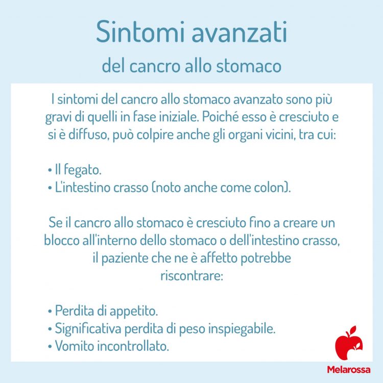 Tumore allo stomaco che cos'è, cause, sintomi, diagnosi, cure Tumore allo stomaco che cos'è, cause, sintomi, diagnosi, cure