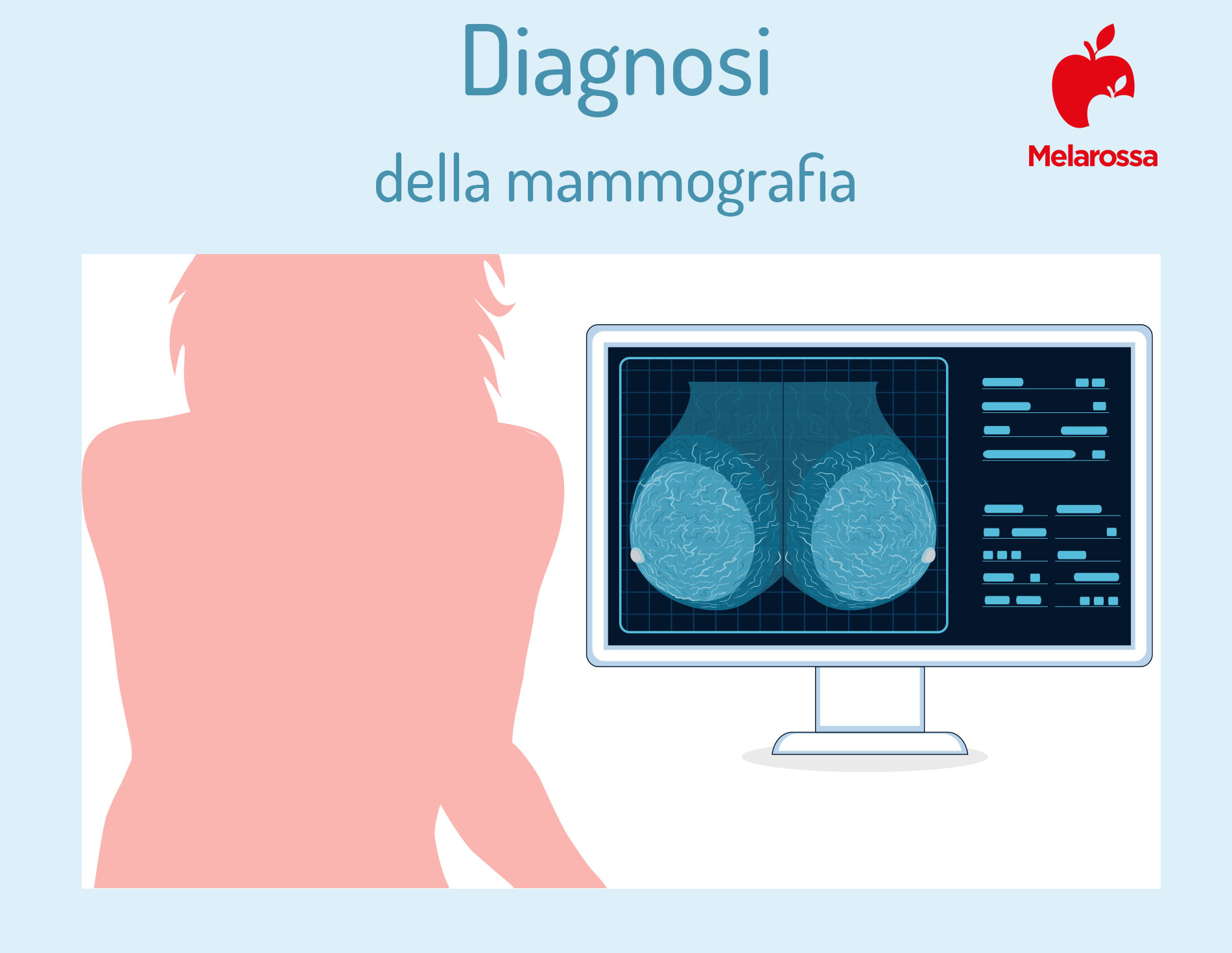 mammografia: diagnosi 