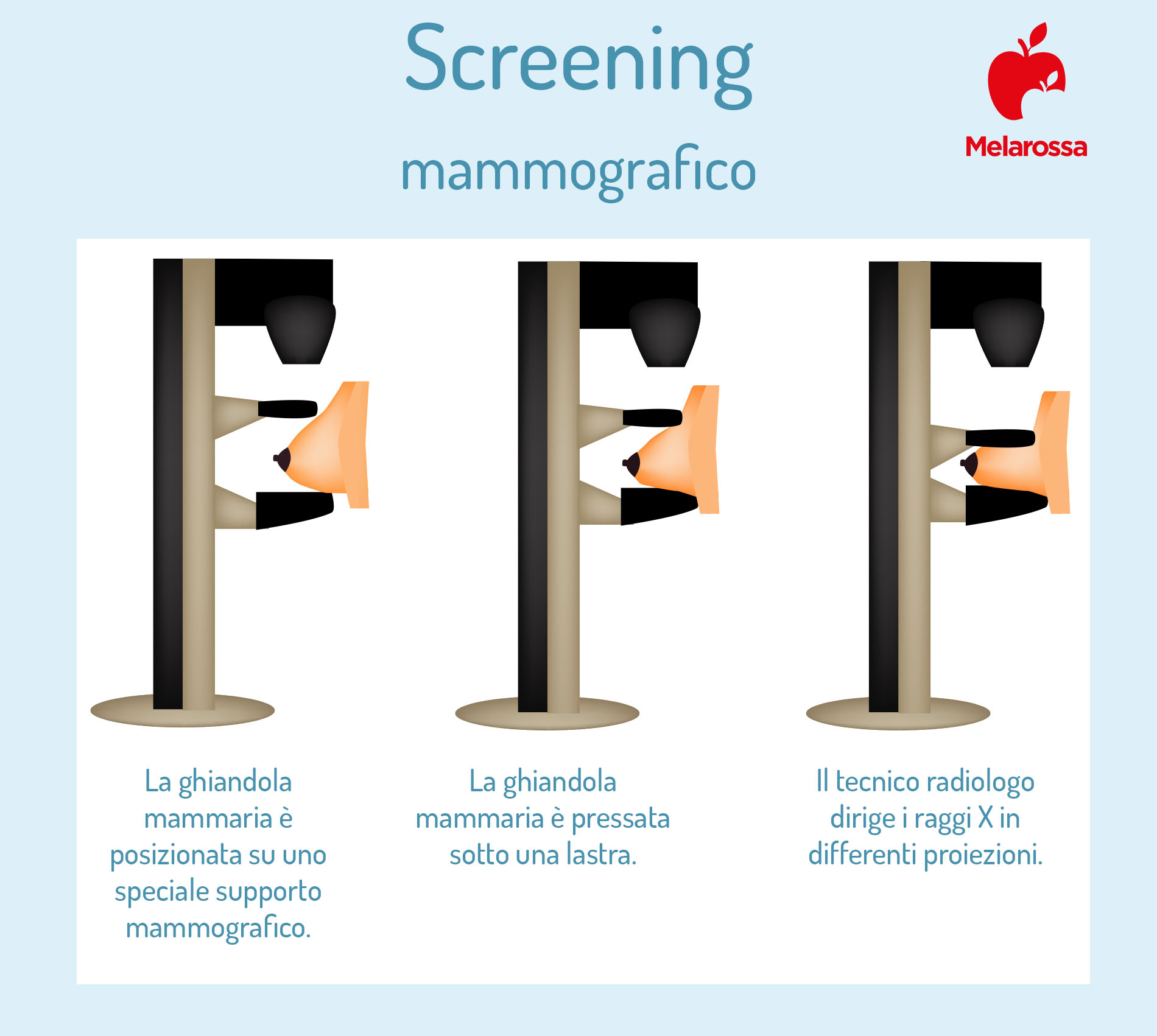 mammografia: come si esegue l'esame