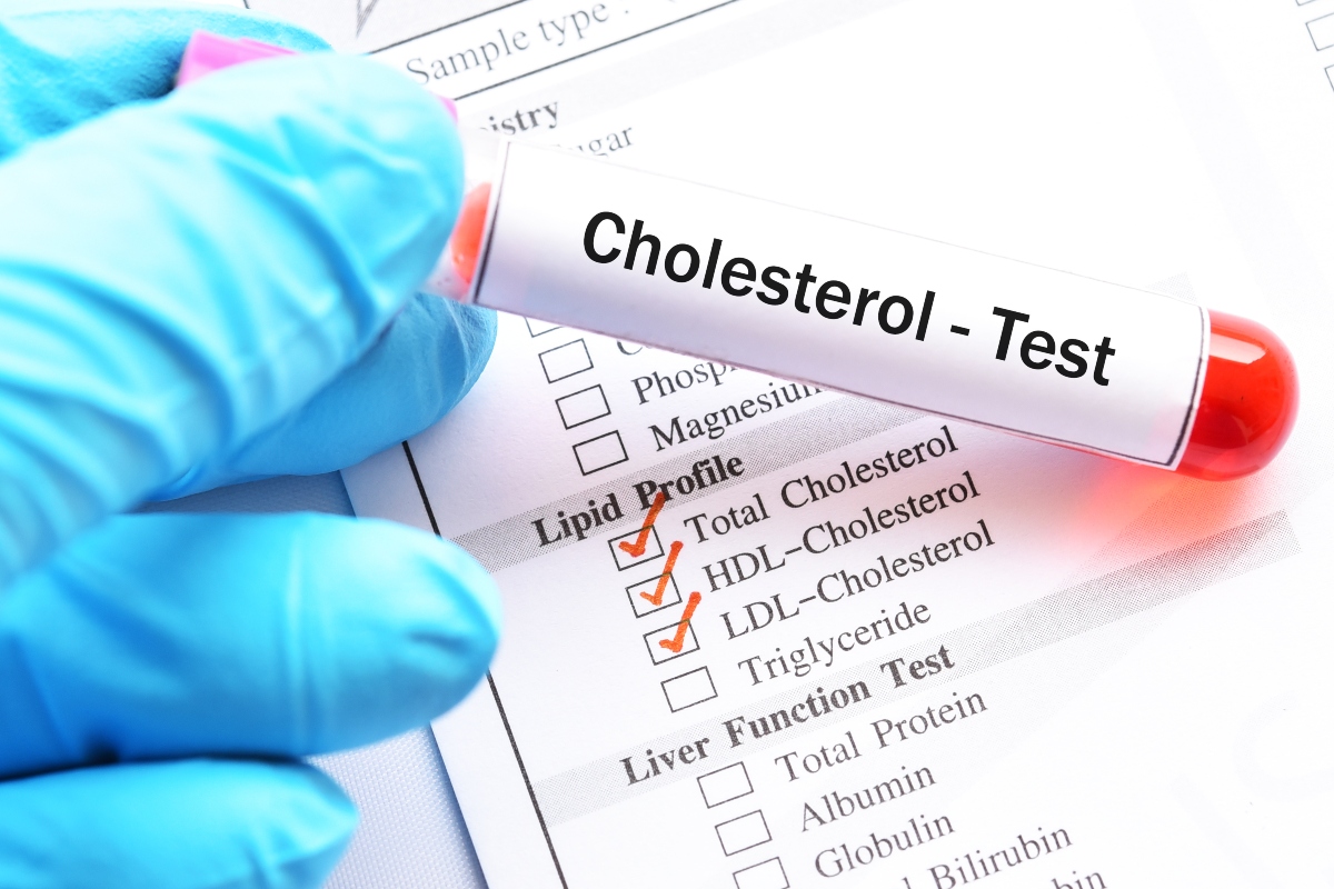 colesterolo totale: analisi del sangue 