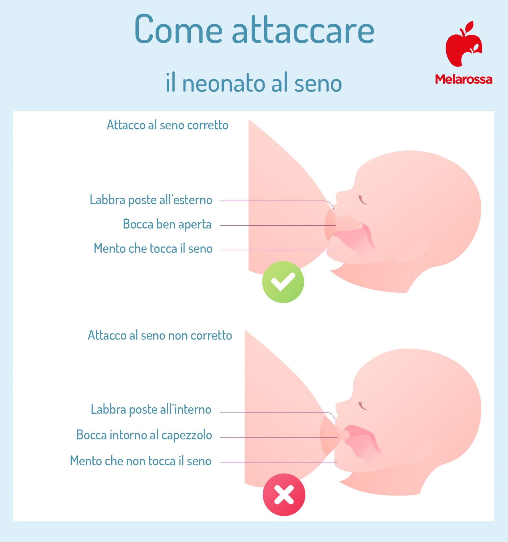 mastite allattamento al seno come attaccare il neonato al seno 1