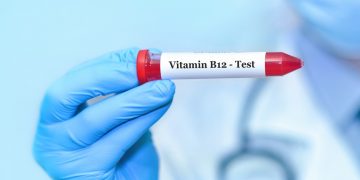 anemia perniciosa: che cos'è, sintomi, cause, sintomi, diagnosi