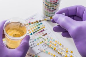 Proteine nelle urine (proteinuria): cosa sono, valori e cosa fare quando sono bassi o alti