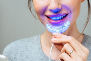 Sbiancamento dentale Led: cos’è, come funziona, risultati, i migliori trattamenti da fare a casa