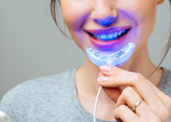 sbiancamento dentale LED: che cos'è, come funziona, risultati, benefici, i migliori sul mercato