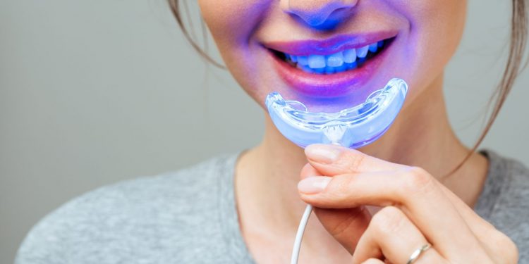 sbiancamento dentale LED: che cos'è, come funziona, risultati, benefici, i migliori sul mercato
