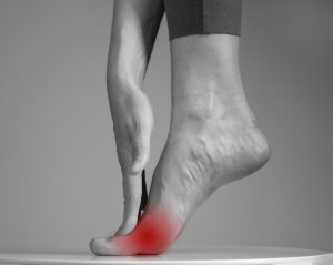 Neuroma di Morton o metatarsalgia: che cos’è, sintomi e cause, come si cura