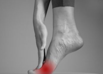 Neuroma di Morton: che cos'è. sintomi e cause, diagnosi e cure