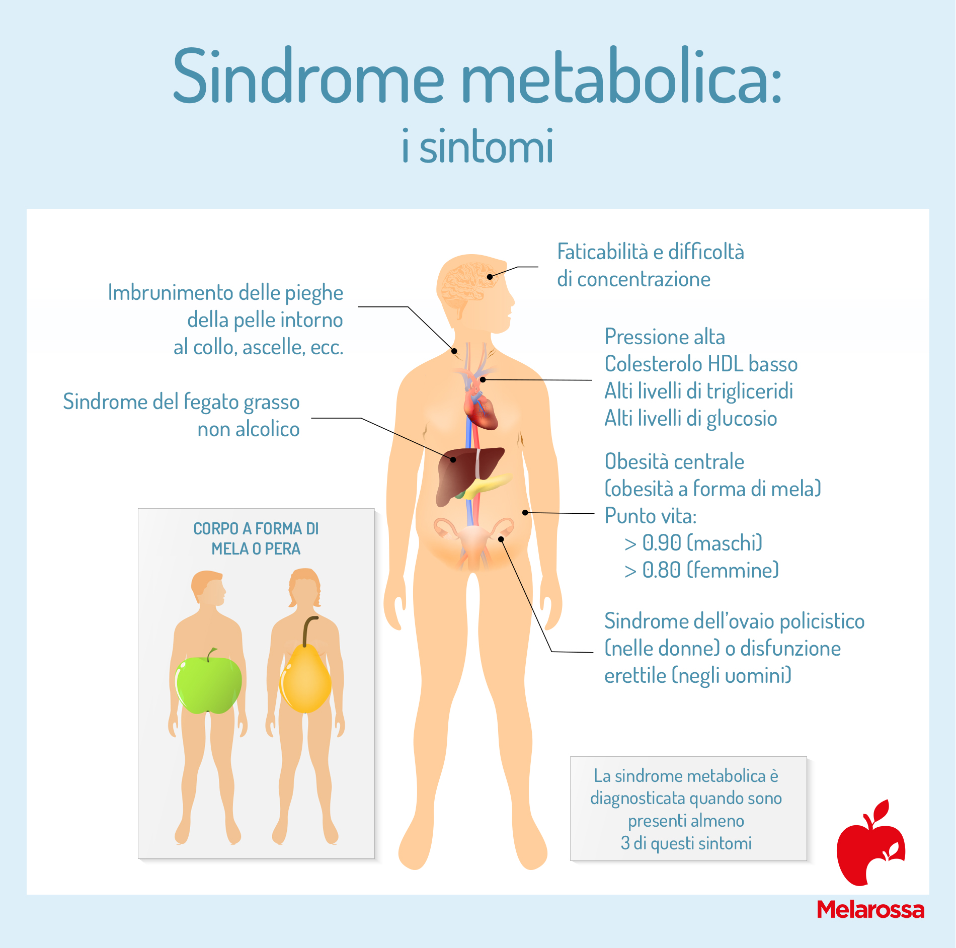 sintomi della sindrome metabolica 