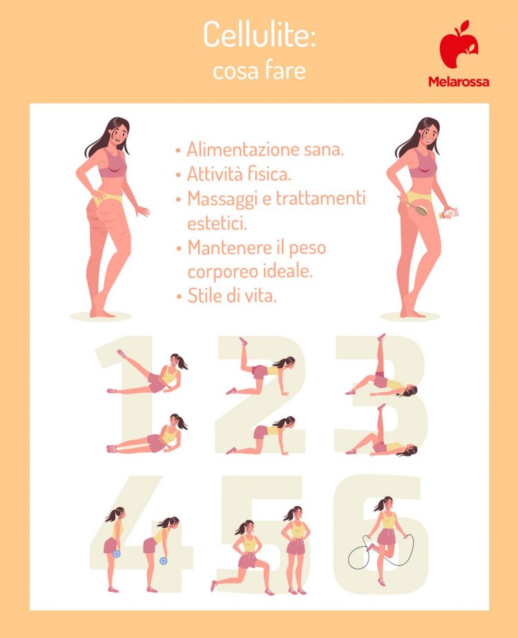 Cellulite o ritenzione idrica? Scopri le differenze - Melarossa