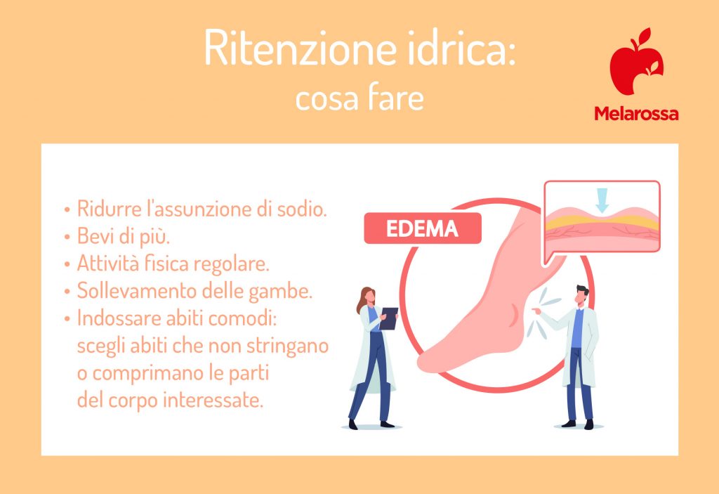 Cellulite o ritenzione idrica? Scopri le differenze Melarossa