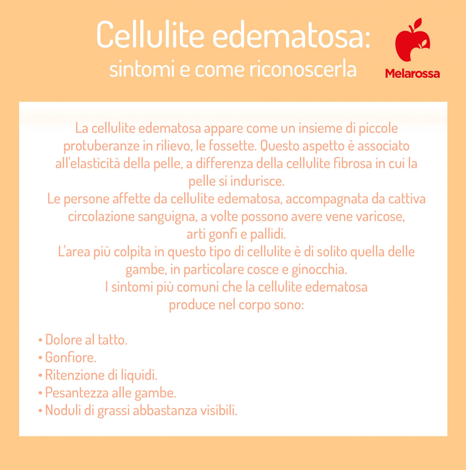 cellulite edematosa: sintomi