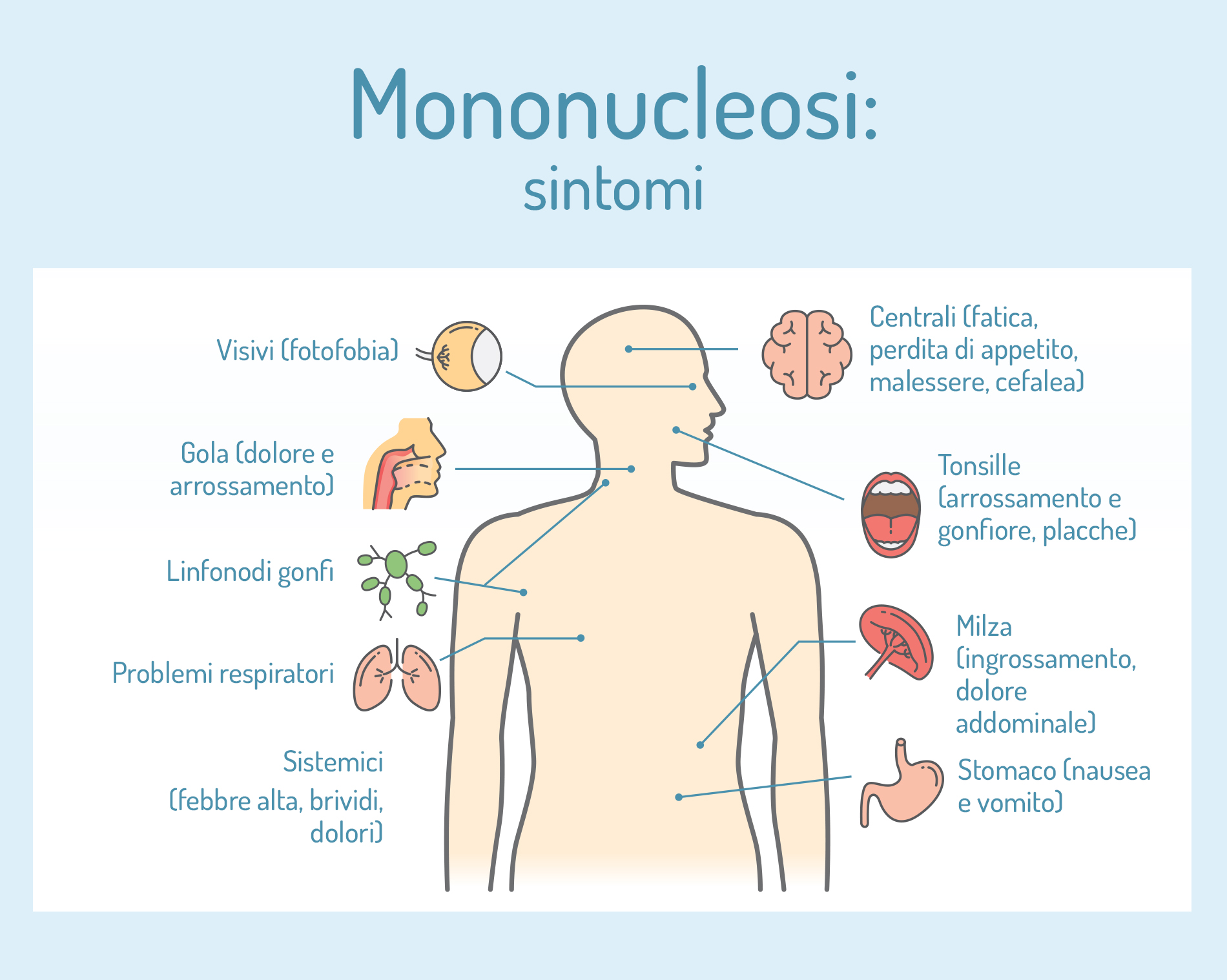 mononucleosi e placche in gola: sintomi  